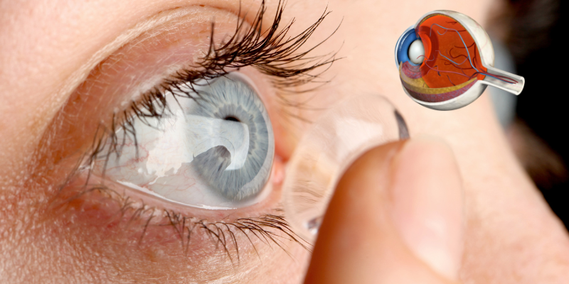 Untitled Design 47 Smart Contact Lenses